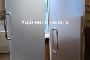 Удаление налета — Хамула Яна Николаевна