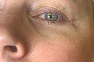 Котова Виктория Владимировна — Фото до; Сделано для сравнения — Портфолио №17