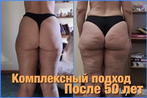 Комплексный подход, массаж, косметика, спорт и питание дает шикарный результат, даже когда тебе уже немного за50лет.... — Антонова Татьяна Николаевна