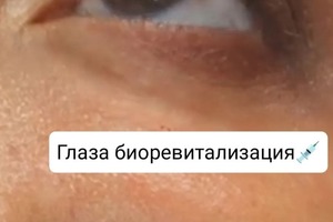 Глаза — Шанькова Татьяна Владимировна