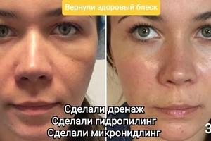 Косметология лица — Шанькова Татьяна Владимировна