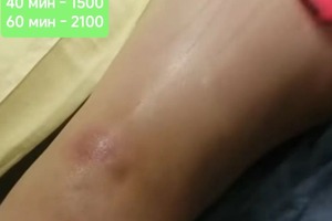 Горячий массаж — Шанькова Татьяна Владимировна