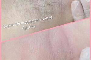 Депиляция мужских подмышек воском — Диянова Светлана Викторовна