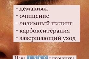 Карбокситерапия швейцарского бренда ТеТе - 1500 р, при покупке курса из 5 процедур 7500 р — Ахатова Алсу Винеровна