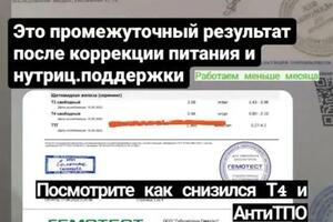 Работа с щит.железой требует грамотного подхода! Особенно когда антитела задействованы. — Салахутдинова Алия Загитовна