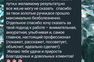 Аппаратная мезотерапия,работали над качеством кожи (убирали сеть морщинок) — Филимонова Римма Романовна