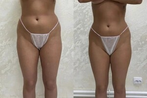 Каатлепсия 4000р час — Голубева Ирина Олеговна