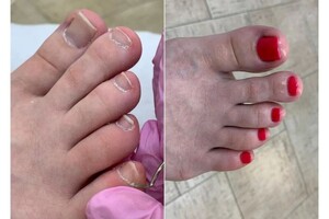 Аппаратный педикюр+ покрытие гель-лаком. — Екатерина Викторовна