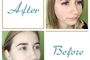 Before/After — Елецкая Анастасия Яковлевна