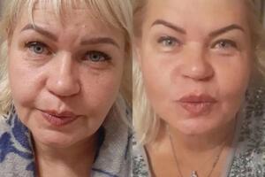 Full face: Ботокс, филлер, коктейль Монако. — Галиева Юлия Маратовна