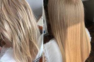 Биксипластия — Кудряева Елена Евгеньевна