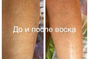 До и после — Усикова Анастасия Андреевна