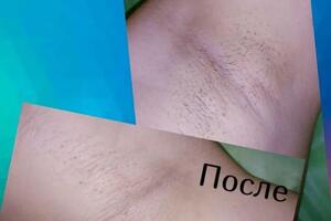 Депиляция восками SKIN\'S — Филиппова Юлия Сергеевна