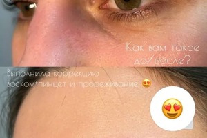 Прореживание бровей это процедура облегчения формы бровей, которая также визуально осветляет их за счёт удаления волос... — Зверева Анастасия Сергеевна