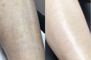 Белова Милана Юрьевна — Голени — Портфолио №8