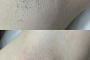 Белова Милана Юрьевна — Подмышечные впадины — Портфолио №9