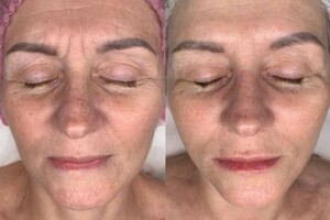 Белова Светлана Георгиевна — Биотерапия с пептидами, аминокислотами, экзосомами — Портфолио №10