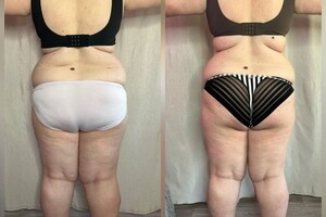 Буюрова Ольга Анатольевна — Портфолио №3