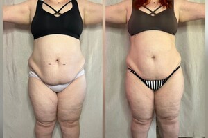 Буюрова Ольга Анатольевна — Портфолио №4