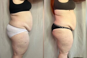 Буюрова Ольга Анатольевна — Портфолио №5