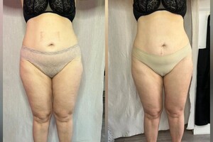 Буюрова Ольга Анатольевна — Портфолио №6