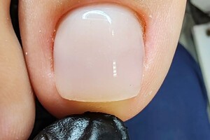 Царегородцева Екатерина Николаевна — Если у вас по какой либо причине отсутствует часть ногтевой пластины, её можно спротезировать, тем самым вернуть... — Портфолио №1