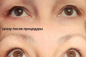 Черненко Евгения Юрьевна — Первичная процедура — Портфолио №11