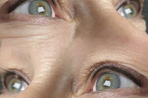 Черненко Евгения Юрьевна — Первичная процедура — Портфолио №12