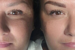 Черненко Евгения Юрьевна — Первичная процедура — Портфолио №8