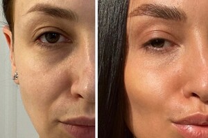 Дрыга Алина Александровна — АВТОРСКАЯ МАНУАЛЬНАЯ ПРОГРАММА ОМОЛОЖЕНИЯ. Комплексный подход набазе методов биомеханики старения, anti-age протокола,... — Портфолио №1