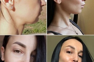 Дрыга Алина Александровна — Комплексная программа омоложения. — Портфолио №2