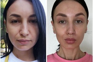 Дрыга Алина Александровна — Комплексная программа омоложения. — Портфолио №4