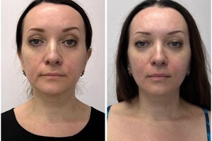 Дрыга Алина Александровна — 8 сеансов омолаживающего массажа — Портфолио №5