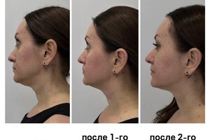 Дрыга Алина Александровна — Промежуточный результат курса омоложения. — Портфолио №6