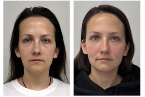 Дрыга Алина Александровна — Антифиброзный массаж лица — Портфолио №8