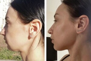 Дрыга Алина Александровна — АВТОРСКАЯ МАНУАЛЬНАЯ ПРОГРАММА ОМОЛОЖЕНИЯ. — Портфолио №9