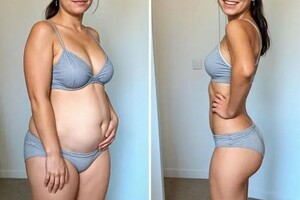 Федосеева Анастасия Сергеевна — Антицеллюлитный массаж — Портфолио №10