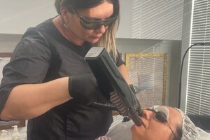 Федосеева Анастасия Сергеевна — Карбоновый пилинг. Омоложение, сужение пор, терапия акне, оздоровление и сужение кожного лоскута ( лазерная процедура+... — Портфолио №4