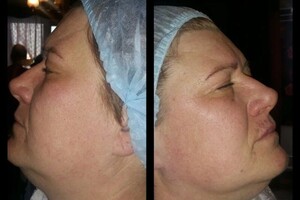 Гасюль Ольга Григорьевна — Лечение остеохондроза, проработка мышц! — Портфолио №12