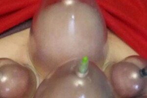 Гасюль Ольга Григорьевна — Висцеральный массаж живота, при постановке вакуумных банок. Восточная традиционная медицина Китая! — Портфолио №19