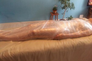 Гасюль Ольга Григорьевна — Боли в спине, защемление седалещного нерва. Лечение вакуумными банками — Портфолио №25