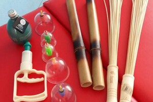 Гасюль Ольга Григорьевна — Лечение зажима седалищного нерва — Портфолио №26