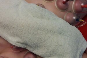 Гасюль Ольга Григорьевна — Убираем живот Вакуумными банками! — Портфолио №28