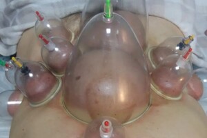 Гасюль Ольга Григорьевна — Массаж Вакуумными банками! Проработка мышц, лечение остеохондроза. — Портфолио №31