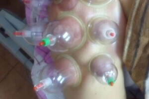 Гасюль Ольга Григорьевна — Мазь для лечения суставов, разогрева мышц, для лечения поясницы, шейноворотниковой зоны. — Портфолио №36