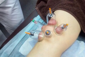 Гасюль Ольга Григорьевна — Корректирующщий массаж на ингибиторе. После двух процедур — Портфолио №41