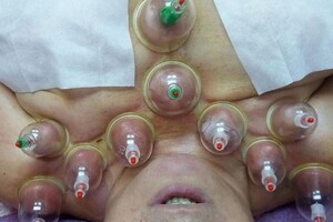 Гасюль Ольга Григорьевна — Вакуумные банки. Работа с грудным отделом — Портфолио №47