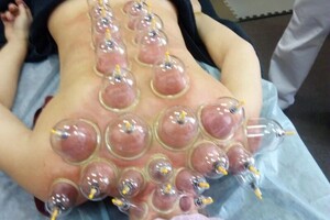 Гасюль Ольга Григорьевна — Работа с шейноворотниковой зоной и спиной — Портфолио №49