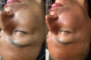 Имгрунт Анна Романовна — Портфолио №1