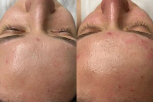 Имгрунт Анна Романовна — Портфолио №2